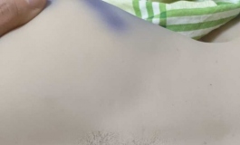 你们娃娃有没有出现过这种情况！？能修复吗？