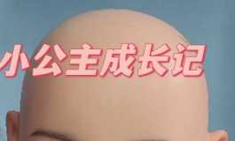 诚接植发199元包邮
