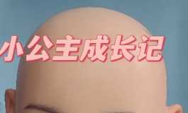诚接植发199元包邮