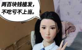 199元接单植发！！